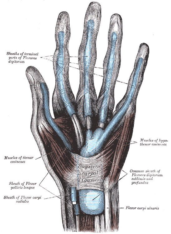 Diagram of the flexor tendon sheaths of the palm with the pulleys at the base of the fingers boxed in red
